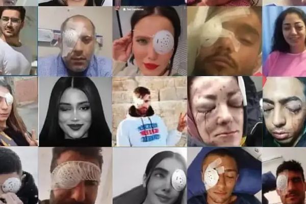 منظمة حقوق الإنسان الإيرانية تعلن عن 138 إصابة على الأقل في العين برصاص نظام طهران