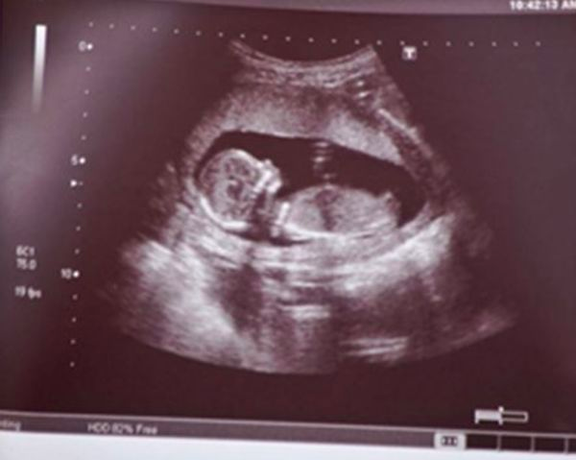 رییس انجمن علمی ژنتیک پزشکی ایران: واردات و تولید کیتهای غربالگری ممنوع شده است