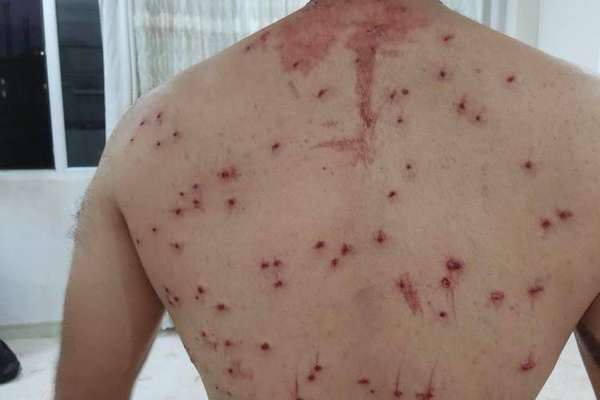 UN Expresses Concern On Iran Situation Criticizing Regime Crackdown