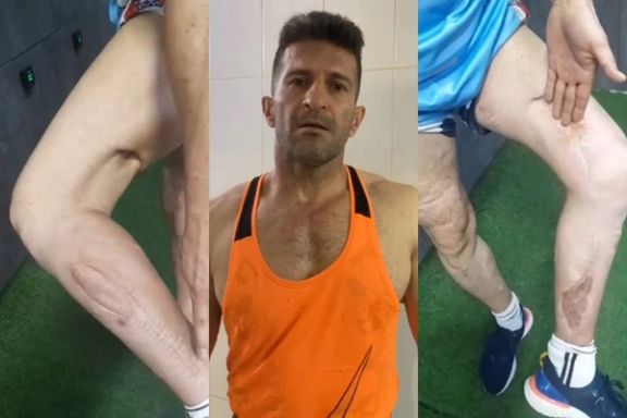 پاسخ مراجع قضایی به شکایت یکی از مجروحان آبان ۹۸: به ما ربطی ندارد