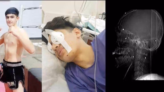 تصاویری از زانیار پیش و پس از شلیک ماموران و اسکن مغزی او