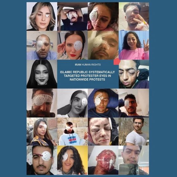 گزارش سازمان حقوق بشر ایران از شلیک هدفمند و سیستماتیک ماموران حکومت به چشم معترضان