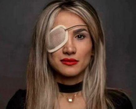 Blinded protestor says Iran's fight has moved beyond the hijab