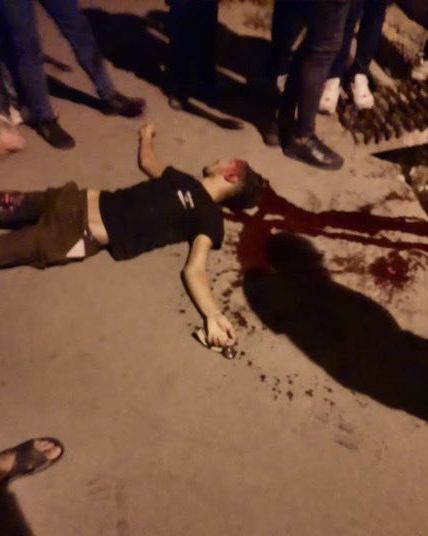 A protester injured by security forces in Rasht, the provincial capital of Gilan