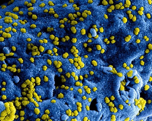 باکتریهای خوب روده ابزاری مفید و قابل دسترس برای مقابله با کووید-۱۹ حاد