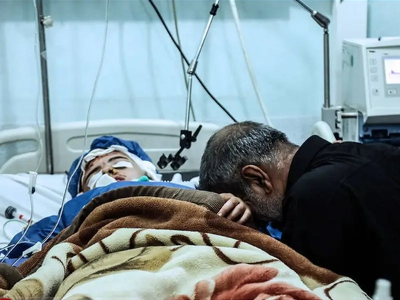 30 ألف إيراني في قائمة الانتظار لزراعة الأعضاء