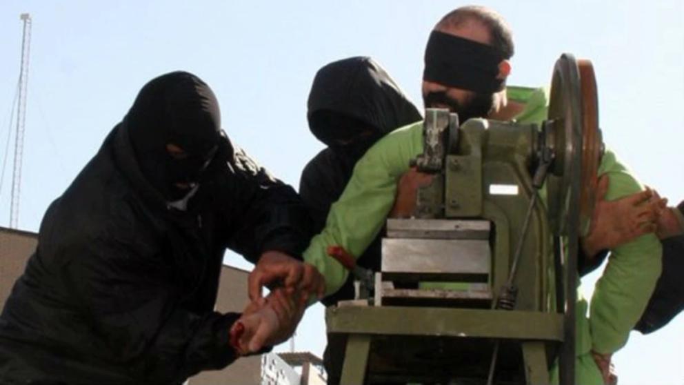 File photo of a prisoner being amputated by a guillotine-like device in Iran