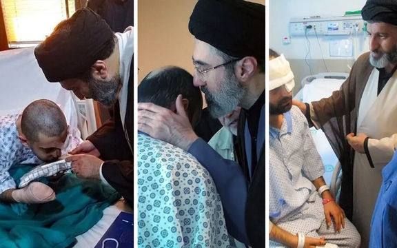 عیادت پسران خامنهای از مجروحان انفجار پیجرهای حزبالله در تهران