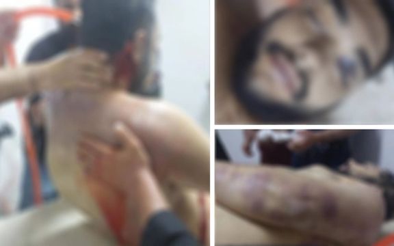 قوه قضاییه: کبودیهای روی جسد پیمان گلوانی به دلیل بسته شدن به تخت بیمارستان است