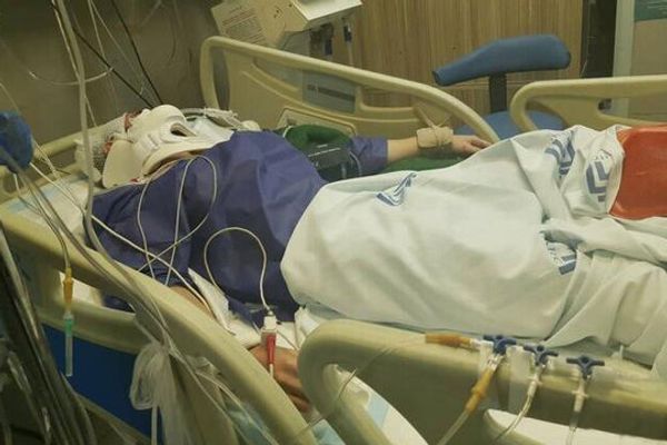 Part Of 14-Year-Old Patient’s Skull Goes Missing In Iran