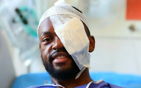 با اعلام سرمربی؛ کوین یامگا، بازیکن استقلال، ادامه فصل را از دست داد