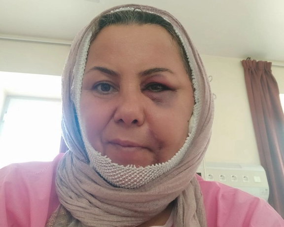 ناپدید شدن پدر یک خانواده در بوکان پس از زخمی شدن همسرش در جریان جنبش مهسا