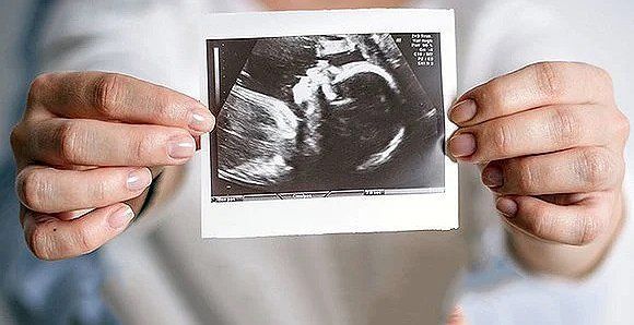 Tasnim News Agency Raises Alarm Over Abortion Numbers