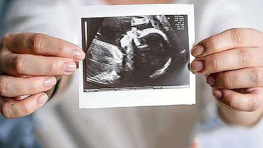An ultrasound image of baby in mother's womb
