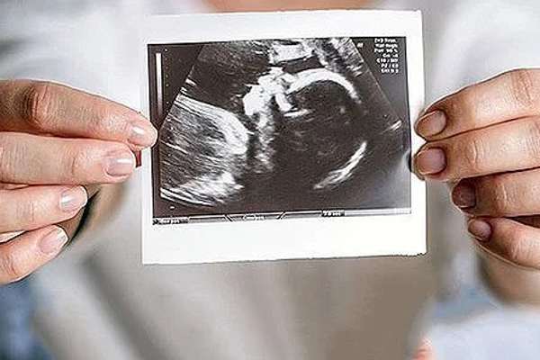 Tasnim News Agency Raises Alarm Over Abortion Numbers