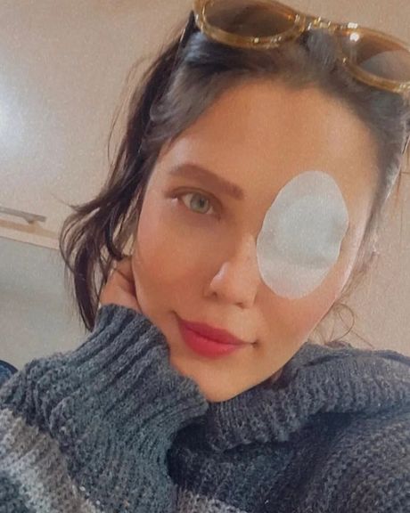 راحله امیری، معترض مجروح: به امید روزی که ما زنان بتوانیم در ایران آزادانه زندگی کنیم